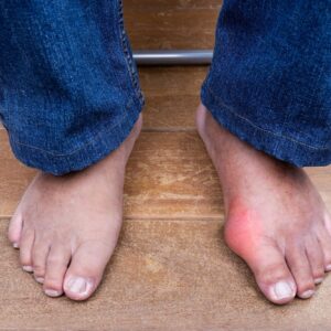 Aussies Make History at World Championships: Major Implications for Gout Awareness!